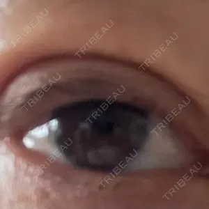 TCB東京中央美容外科 TCB東京中央美容外科 自由が丘院口コミ