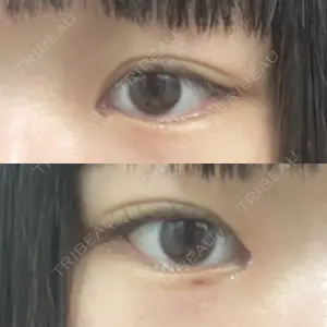 9BeautyClinic口コミ