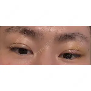 口コミ