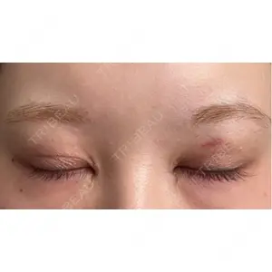 HAAB×DREAM BEAUTY CLINIC HAAB×DREAM BEAUTY CLINIC 東京本院口コミ