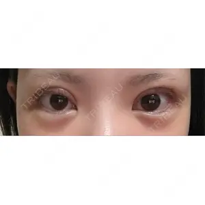 PRO CLINIC プロクリニック 銀座院口コミ
