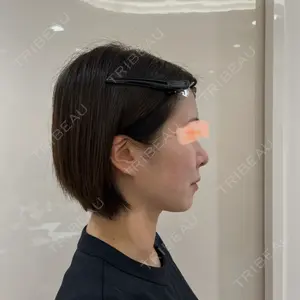 BIANCA CLINIC BIANCA銀座口コミ