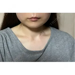 口コミ