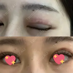 9BeautyClinic口コミ