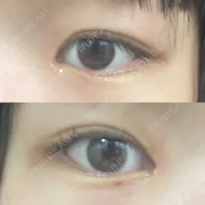 9BeautyClinic口コミ
