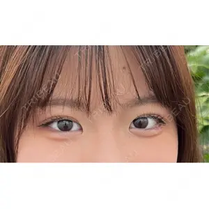 湘南美容クリニック 池袋東口院の