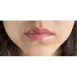 Kinshicho Beauty Clinic （錦糸町ビューティークリニック）口コミ