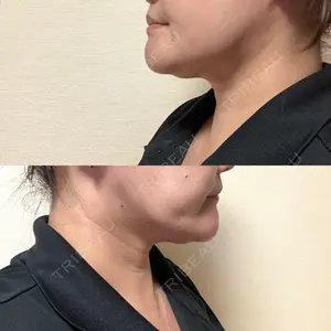 銀座マイアミ美容外科の