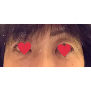 東京美容外科 東京美容外科 梅田院口コミ