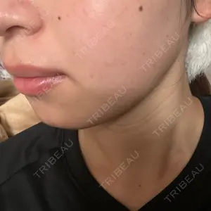 ルラ美容クリニック ルラ美容クリニック 静岡院口コミ