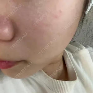 ハナビューティークリニック口コミ