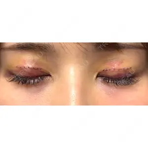 リッツ美容外科 大阪院口コミ
