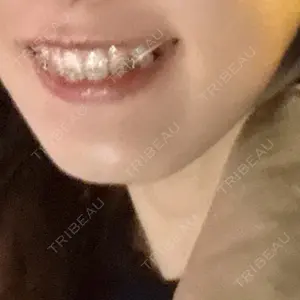 口コミ