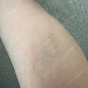 グリシーヌクリニック口コミ