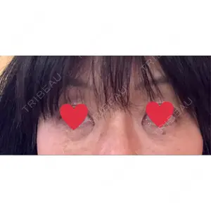 東京美容外科 東京美容外科 梅田院口コミ