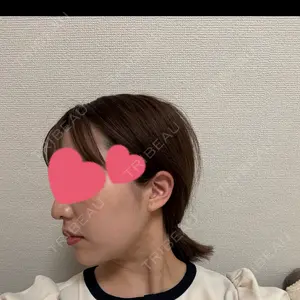 脂肪吸引ラボトウキョウ口コミ