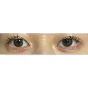 渋谷美容外科クリニック 渋谷美容外科クリニック 渋谷院口コミ