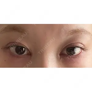 HAAB×DREAM BEAUTY CLINIC HAAB×DREAM BEAUTY CLINIC 東京本院口コミ