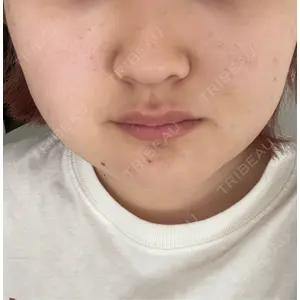 口コミ
