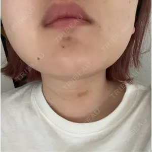 口コミ