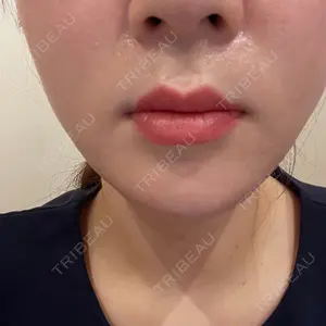 口コミ