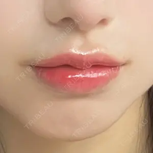 口コミ