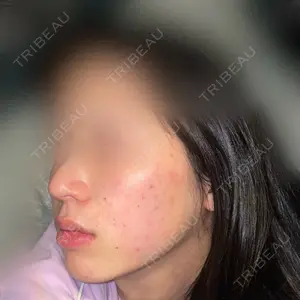 CZEN CLINIC 銀座院口コミ