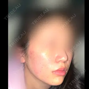 CZEN CLINIC 銀座院口コミ