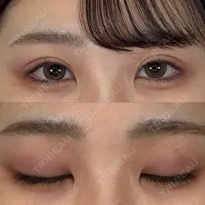 口コミ