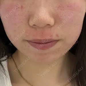 ライズワン美容皮膚科クリニック口コミ