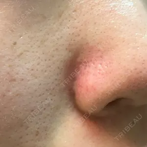 ライズワン美容皮膚科クリニック口コミ