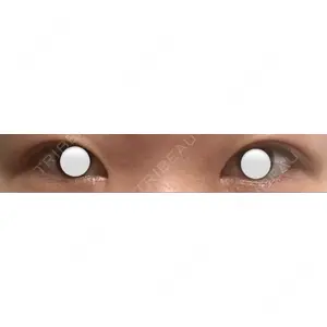 LUHO（ルホ）美容外科口コミ