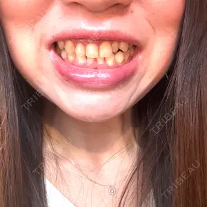 口コミ
