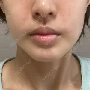 口コミ