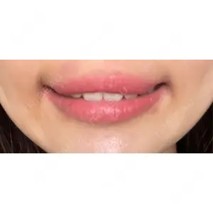 フォンタナクリニック天神口コミ