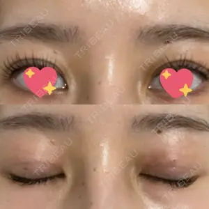 9BeautyClinic口コミ