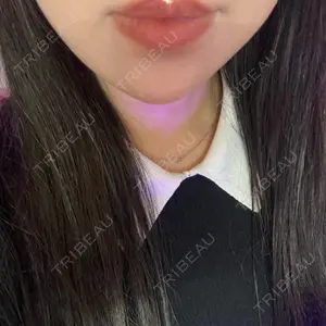 プライベートスキンクリニック 梅田本院口コミ