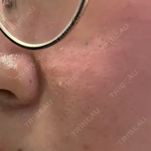 ルラ美容クリニック ルラ美容クリニック 大阪心斎橋院口コミ