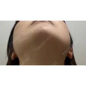 口コミ
