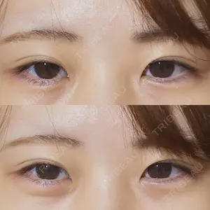 渋谷美容外科クリニック 渋谷美容外科クリニック 渋谷院口コミ