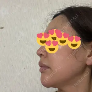 PRO CLINIC プロクリニック 銀座院口コミ