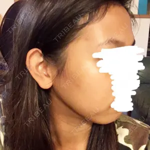 赤坂プレミアクリニック口コミ