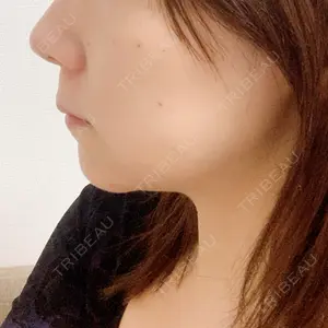口コミ