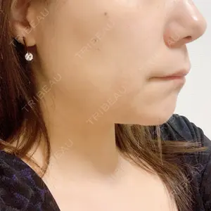口コミ