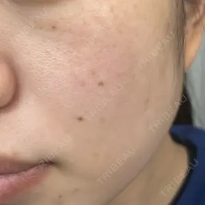 ルラ美容クリニック ルラ美容クリニック 新宿院口コミ