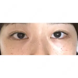 TCB東京中央美容外科 TCB東京中央美容外科 大宮西口院口コミ