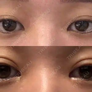 LUHO（ルホ）美容外科口コミ