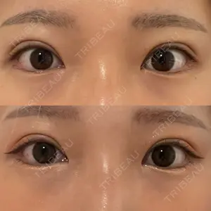 湘南美容クリニック 池袋東口院の