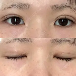 オーキッド美容クリニック東京御徒町口コミ