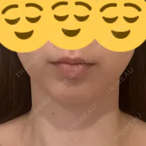 口コミ